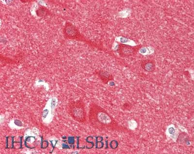 Neuronal Calcium Sensor 1 Antibody in Immunohistochemistry (Paraffin) (IHC (P))