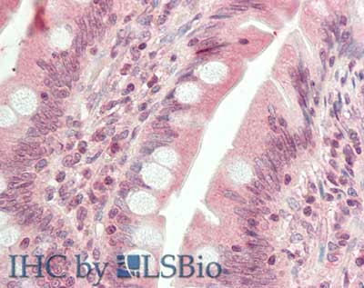 HDAC9 (N-terminus) Antibody in Immunohistochemistry (Paraffin) (IHC (P))