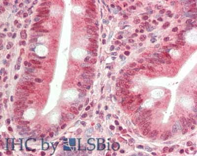 HDAC9 (internal) Antibody in Immunohistochemistry (Paraffin) (IHC (P))