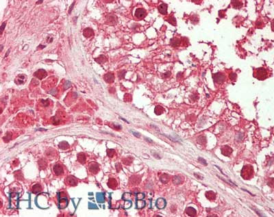 HDAC10 (near N-terminus) Antibody in Immunohistochemistry (Paraffin) (IHC (P))