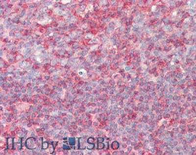 PI4K alpha, type I Antibody in Immunohistochemistry (Paraffin) (IHC (P))
