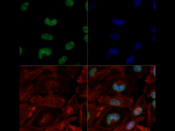 H3K4me3K9ac Antibody in Immunocytochemistry (ICC/IF)