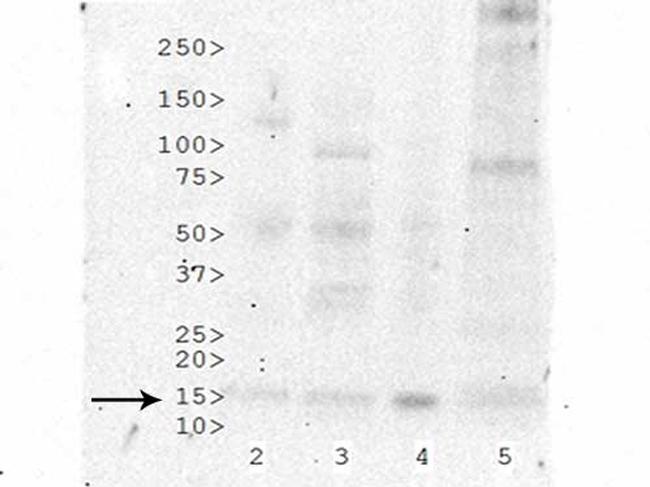 H3K27ac Antibody in Western Blot (WB)
