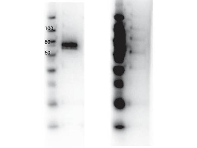 RON Antibody in Western Blot (WB)
