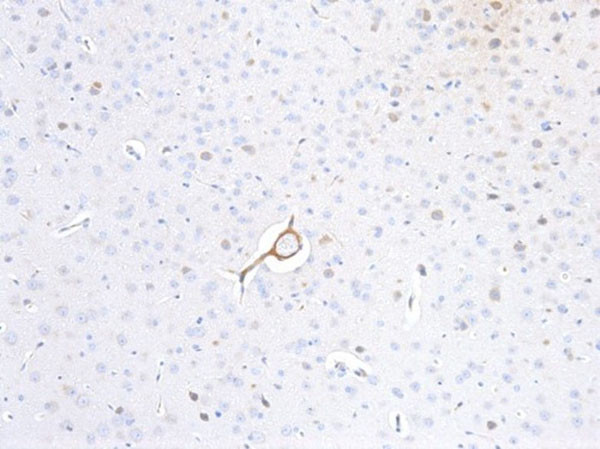 p35 Antibody in Immunohistochemistry (IHC)