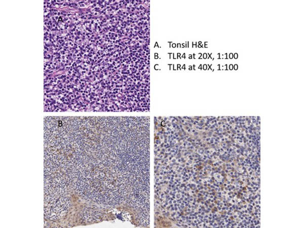 TLR4 Antibody in Immunohistochemistry (IHC)