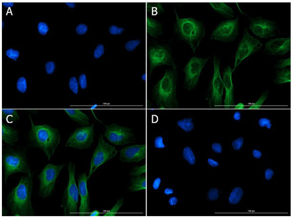 FGFR2 Antibody in Immunocytochemistry (ICC/IF)