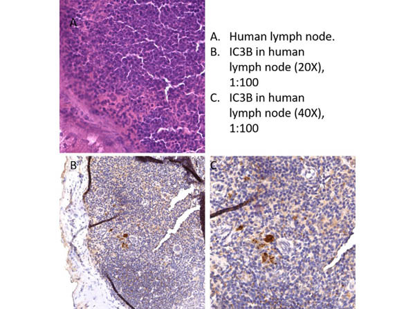 LC3B Antibody in Immunohistochemistry (IHC)