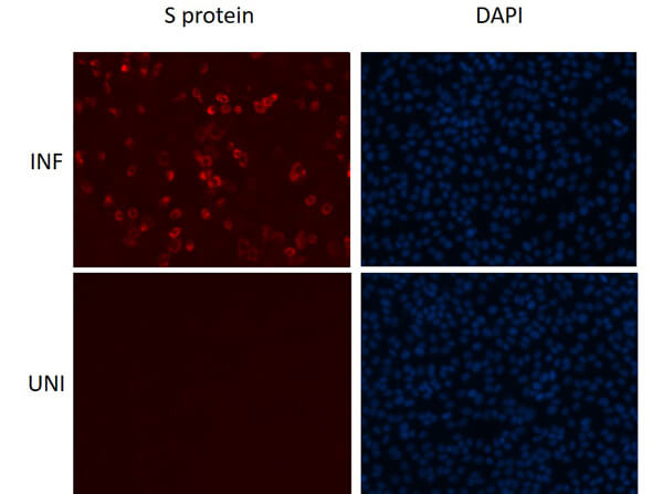 SARS-CoV-2 Spike Protein RBD Antibody in Immunocytochemistry (ICC/IF)