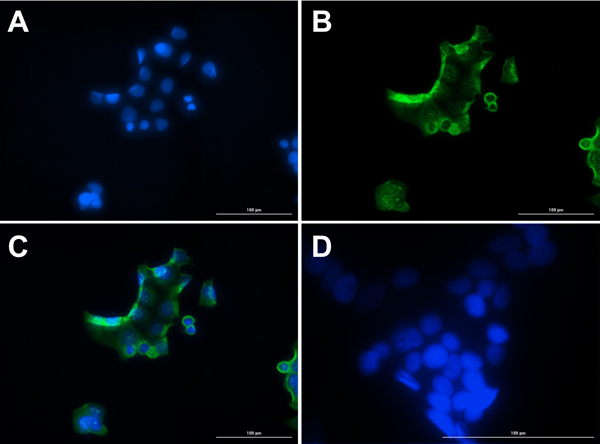 Glucagon Antibody in Immunocytochemistry (ICC/IF)