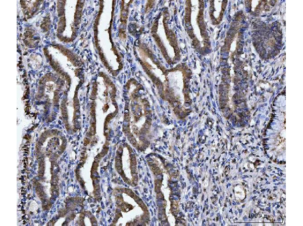 GST pi Antibody in Immunohistochemistry (Paraffin) (IHC (P))