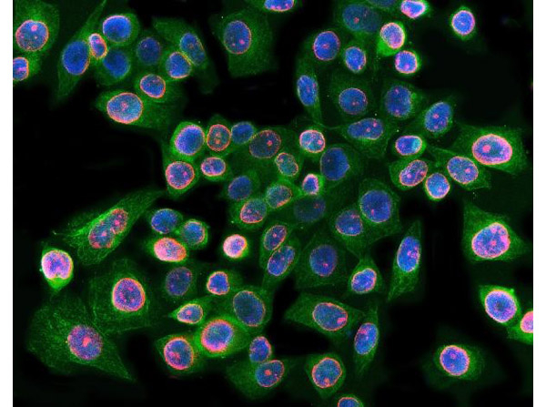 Lamin B1 Antibody in Immunocytochemistry (ICC/IF)