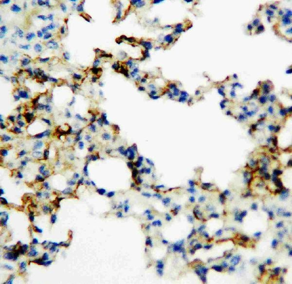 AGER/RAGE Antibody in Immunohistochemistry (Paraffin) (IHC (P))
