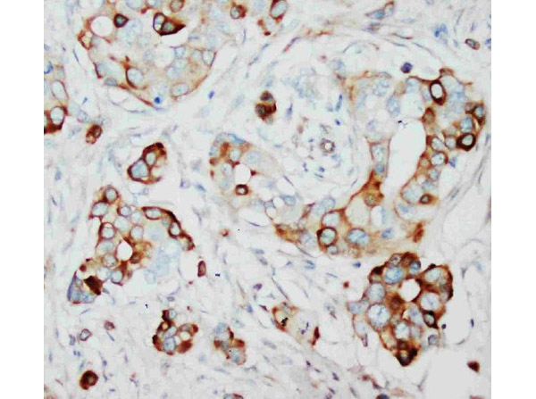 SKP2 Antibody in Immunohistochemistry (Paraffin) (IHC (P))