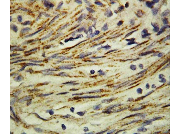 MMP16 Antibody in Immunohistochemistry (Paraffin) (IHC (P))