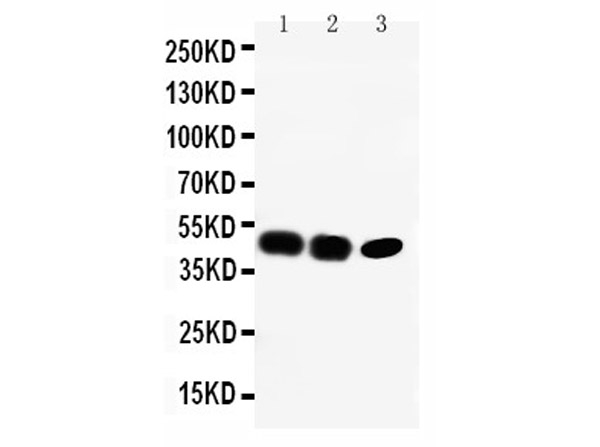 CCR6 Antibody in Western Blot (WB)