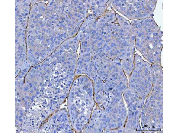 CD34 Antibody in Immunohistochemistry (Paraffin) (IHC (P))