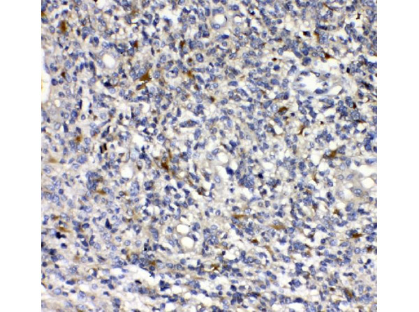PLAUR Antibody in Immunohistochemistry (Paraffin) (IHC (P))