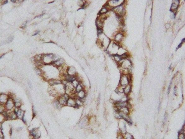 CDC42 Antibody in Immunohistochemistry (Paraffin) (IHC (P))