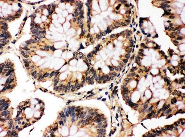 MAPK 8/9 Antibody in Immunohistochemistry (Paraffin) (IHC (P))