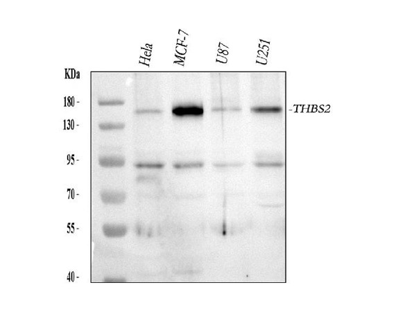 THBS2 Antibody in Western Blot (WB)