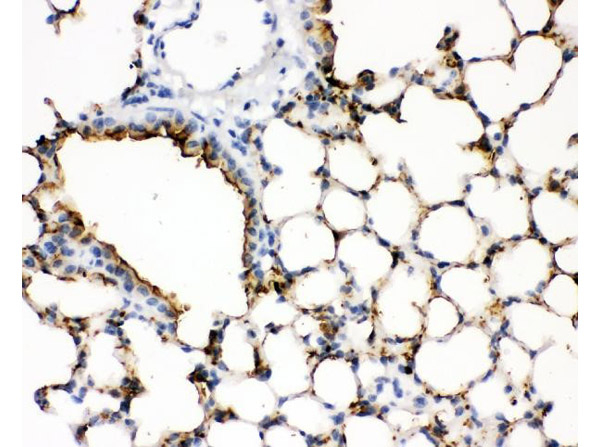 SP-A Antibody in Immunohistochemistry (Paraffin) (IHC (P))