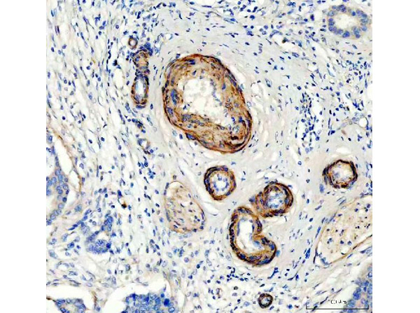 Canstatin Antibody in Immunohistochemistry (Paraffin) (IHC (P))
