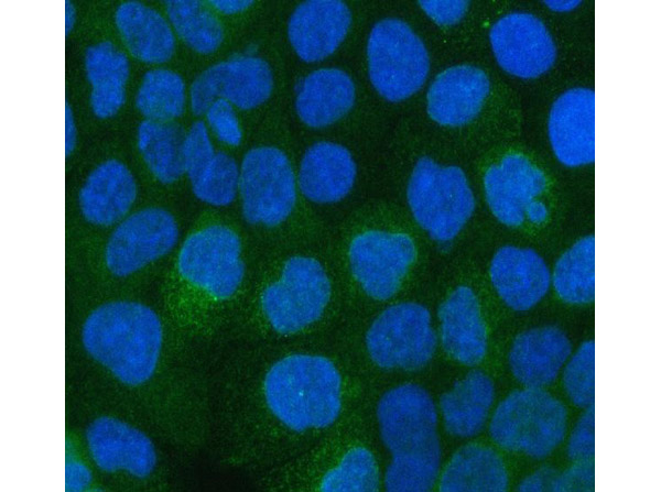 ITGA3 Antibody in Immunocytochemistry (ICC/IF)