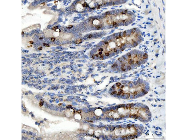 Nox1 Antibody in Immunohistochemistry (Paraffin) (IHC (P))