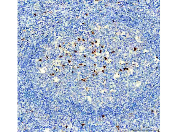 NOX2 Antibody in Immunohistochemistry (Paraffin) (IHC (P))