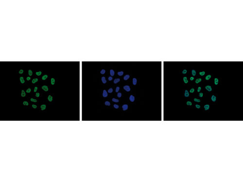 H2A.Zac pan-acetyl (K4,K7,K11) Antibody in Immunocytochemistry (ICC/IF)
