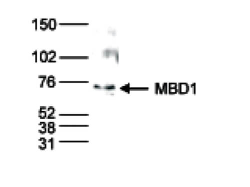 MBD1 Antibody in Western Blot (WB)