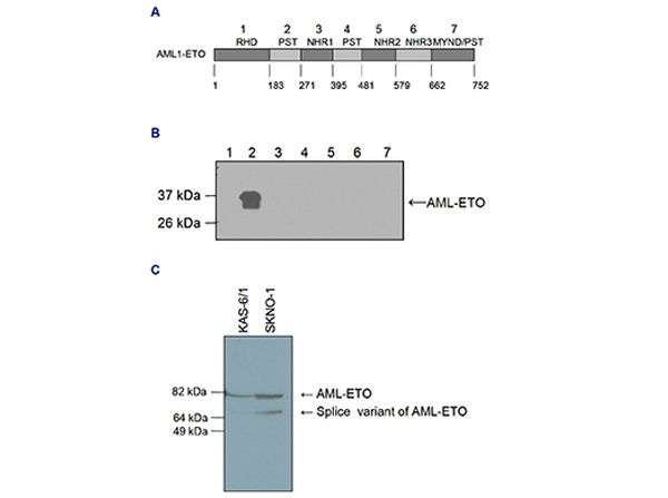 AML-ETO Antibody in Western Blot (WB)