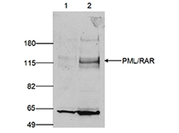 PML Antibody in Western Blot (WB)