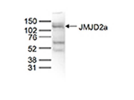 JMJD2A Antibody in Western Blot (WB)