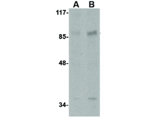 AAK1 Antibody in Western Blot (WB)