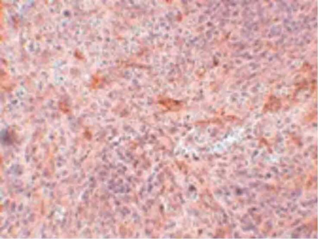 ABIN3 Antibody in Immunohistochemistry (Paraffin) (IHC (P))