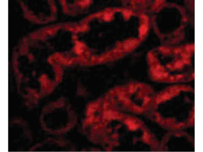 ACE2 Antibody in Immunocytochemistry (ICC/IF)