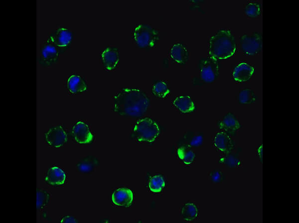 ACE2 Antibody in Immunocytochemistry (ICC/IF)