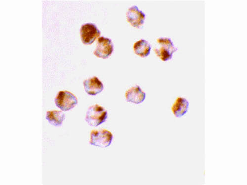 ACINUS Antibody in Immunocytochemistry (ICC/IF)