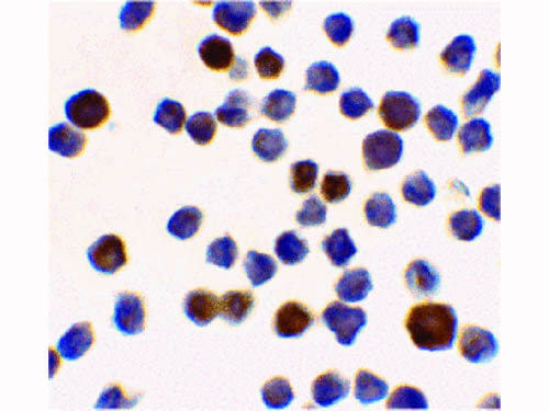 ACINUS Antibody in Immunocytochemistry (ICC/IF)
