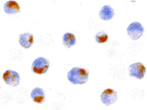 ACINUS Antibody in Immunocytochemistry (ICC/IF)