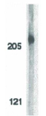 ACINUS Antibody in Western Blot (WB)