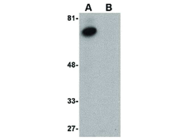 ACVR1B Antibody in Western Blot (WB)