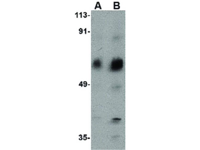 ACVR1C Antibody in Western Blot (WB)