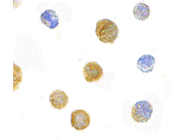 ADAP Antibody in Immunocytochemistry (ICC/IF)