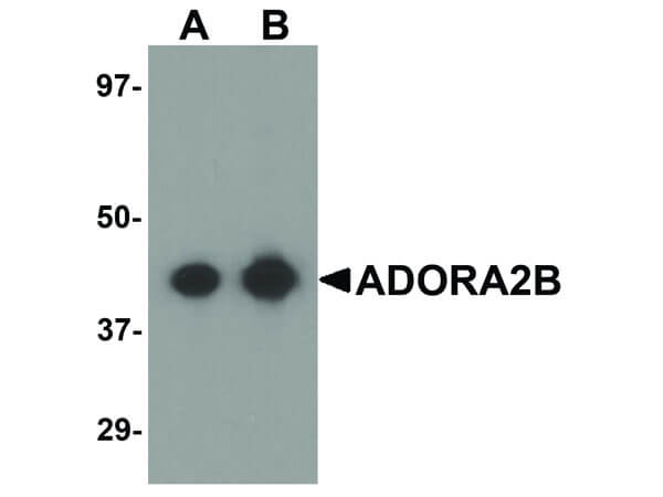 ADORA2B Antibody in Western Blot (WB)