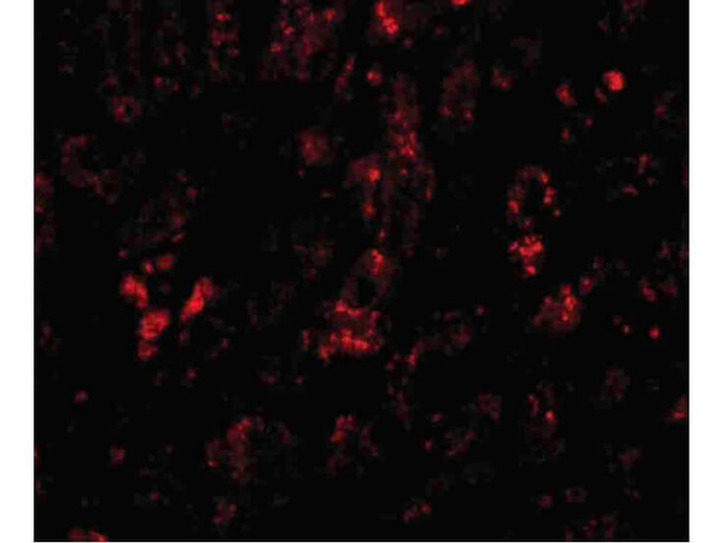 AFAP1L2 Antibody in Immunocytochemistry (ICC/IF)