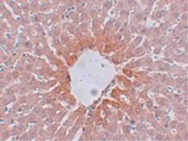 AGTR2 Antibody in Immunohistochemistry (Paraffin) (IHC (P))