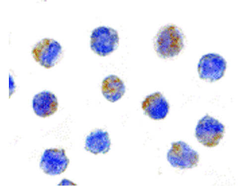 AIF Antibody in Immunocytochemistry (ICC/IF)